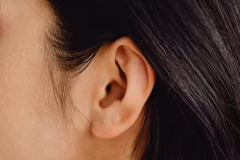 Ear care for Questions Patients Often Ask About Parking and Access - Parking And Access At Surbiton - Private Microsuction E...